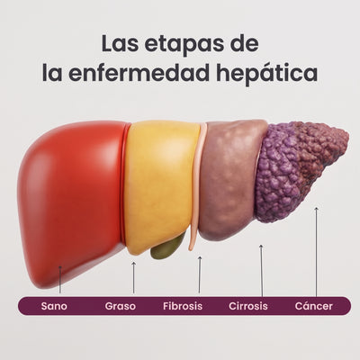 Gotas de Cardo Mariano y Diente de León | Fórmula Detox Hepático